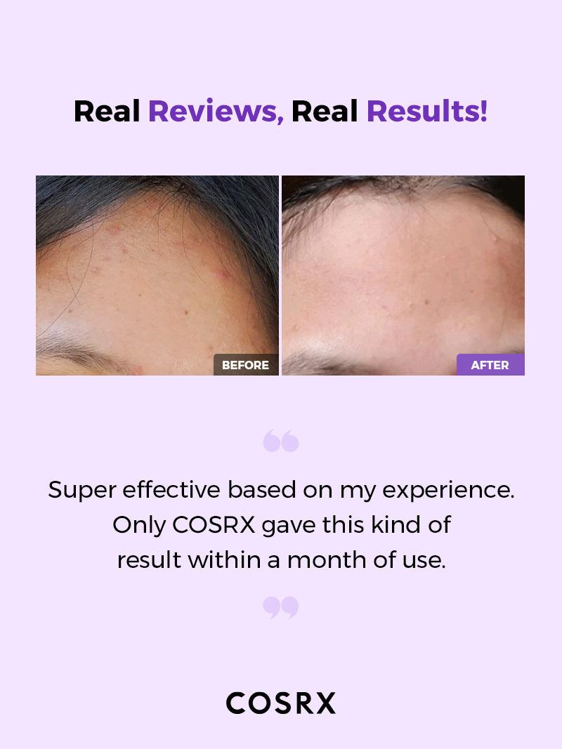 COSRX AHA/BHA Clarifying Treatment Toner 150ml - Image 7