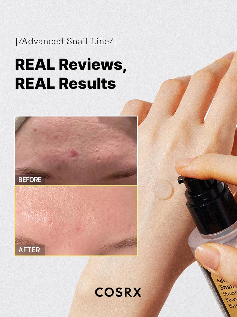 COSRX Advanced Snail 96 Mucin Power Essence 100ml - Image 3