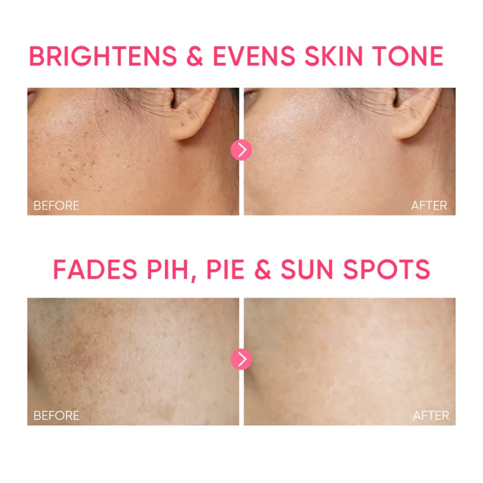 SKINTIFIC Niacinamide Brightening Moisture Gel 30g - Image 4