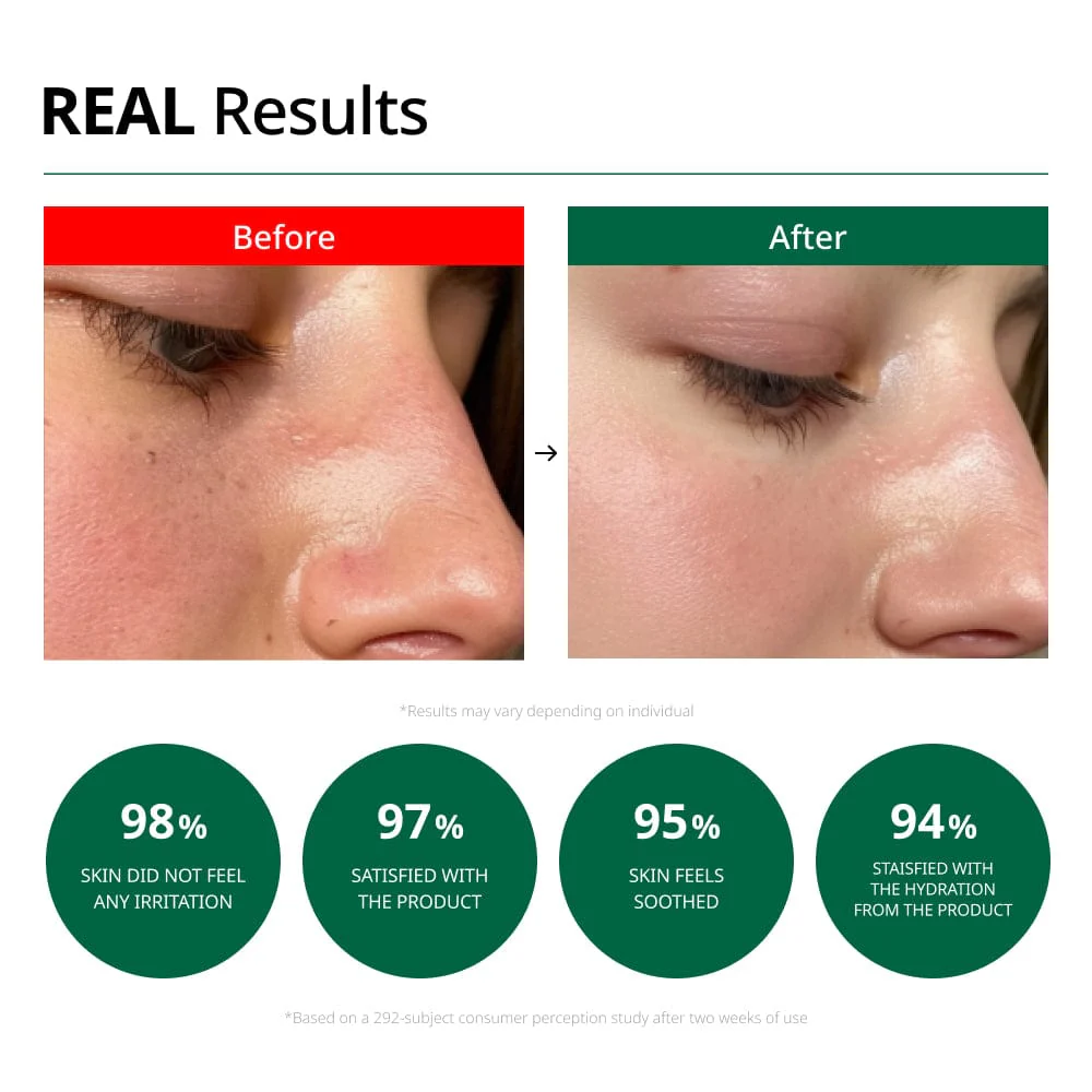 DR.G R.E.D Blemish Clear Soothing Cream 70ml - Image 4