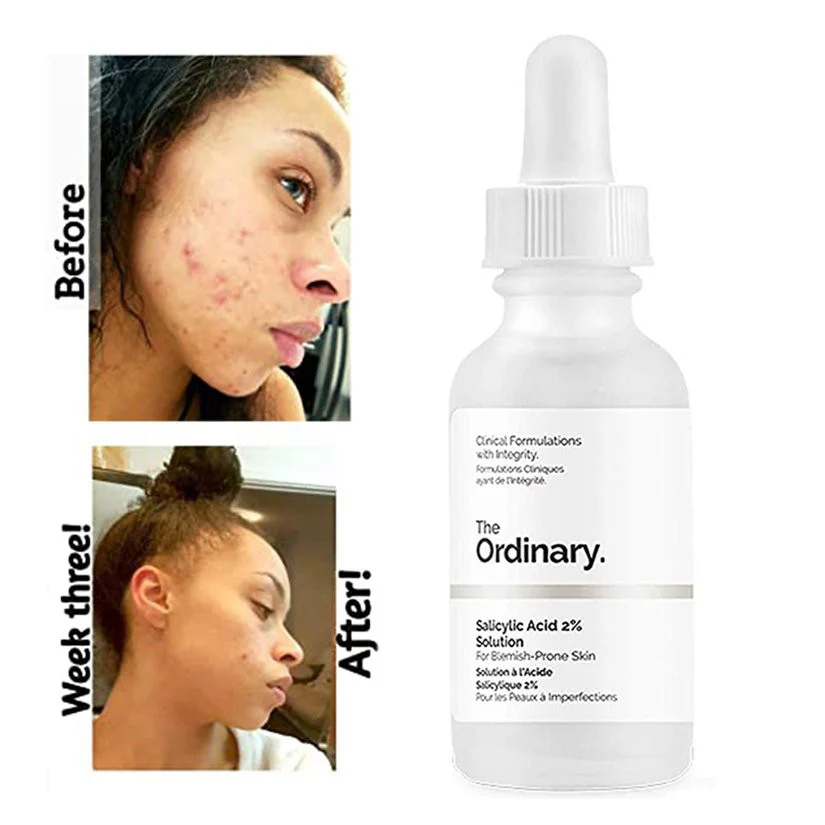 THE ORDINARY Salicylic Acid 2% Solution - Image 2