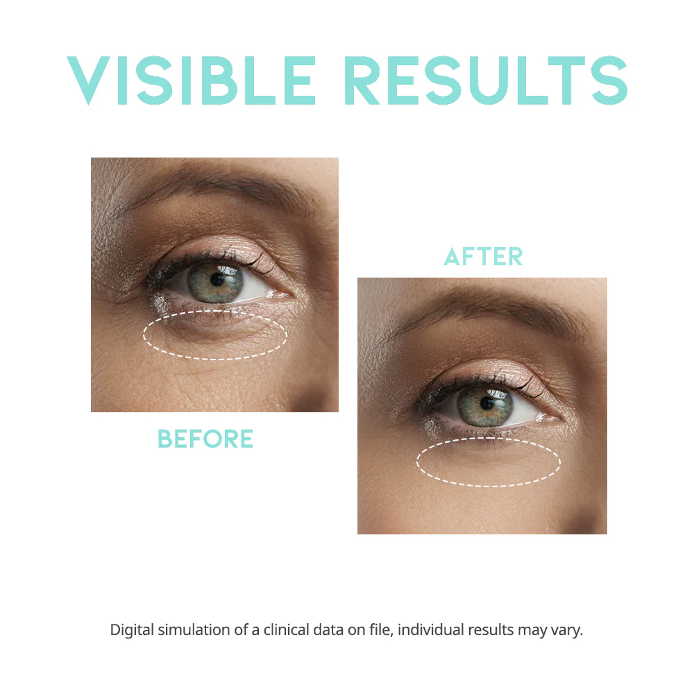 #OOTD Wrinkle Lift Eye Serum 30g - Image 5