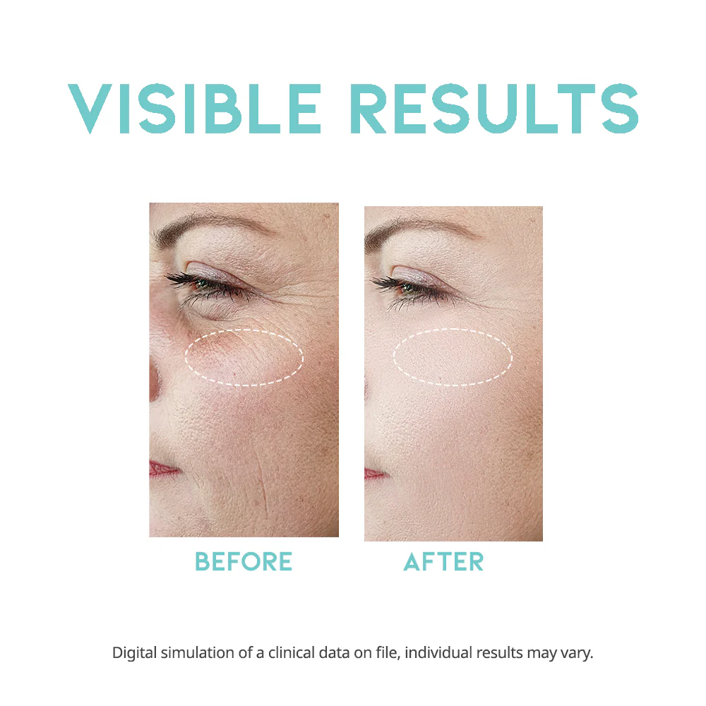 #OOTD Wrinkle Lift Retinol Serum 50ml - Image 6