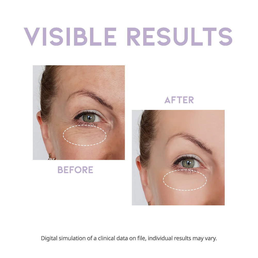 #OOTD Overnight Eye Cream 25g - Image 6