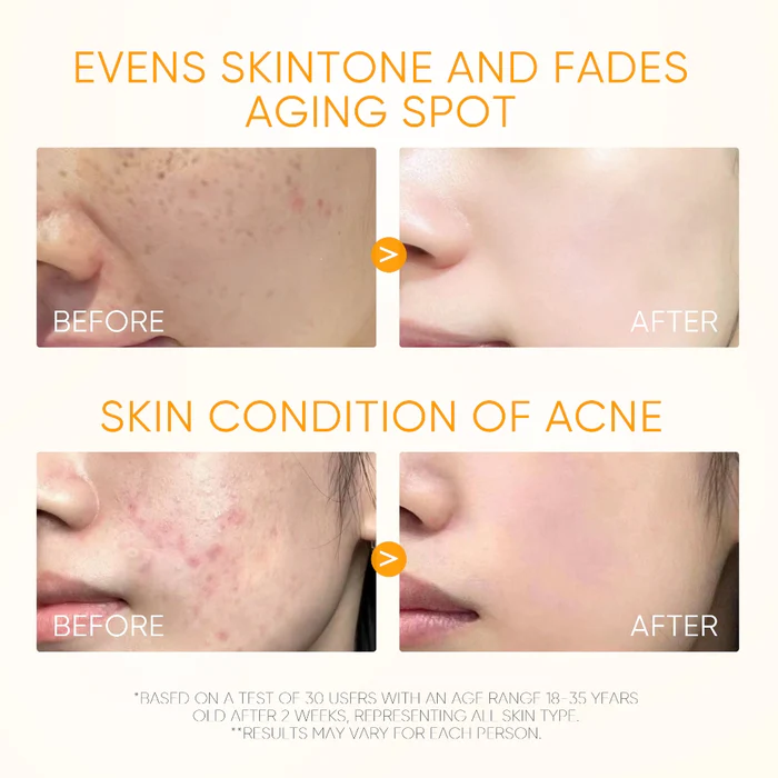 SKINTIFIC Potent Vitamin C Brightening Glow Serum 20ml - Image 7