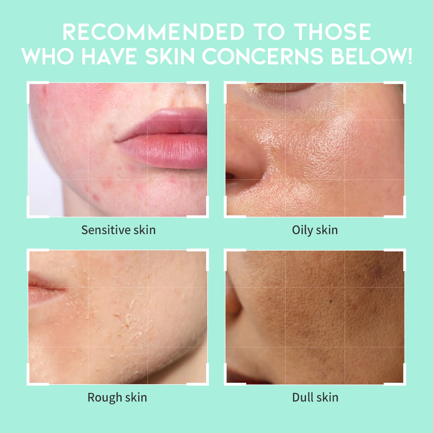 #OOTD Heartleaf Pore Zero Cleanser 200ml - Image 3