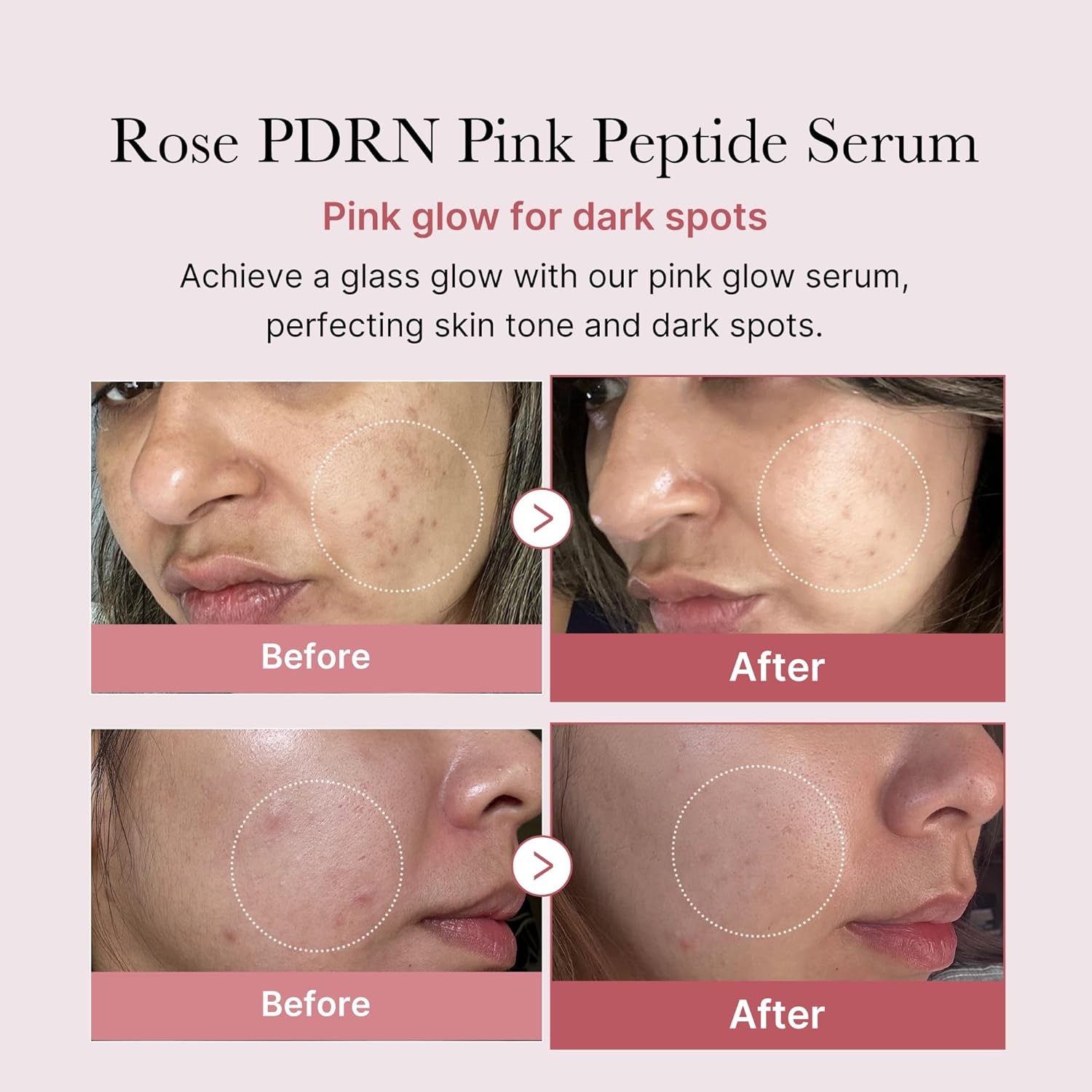 MEDICUBE PDRN Pink Peptide Serum 30ml - Image 5