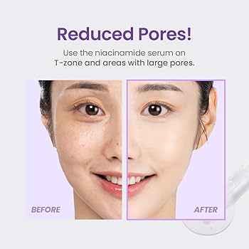 TIRTIR Niacinamide 20% Serum 30ml - Image 2