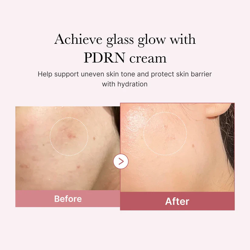 MEDICUBE PDRN Pink Hyaluronic Moisturizing cream 50ml - Image 3