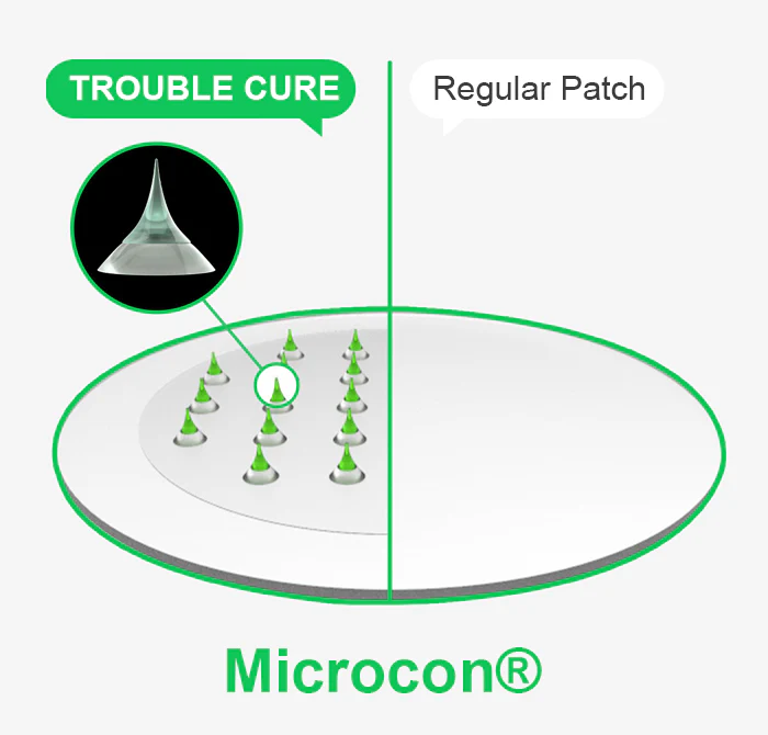 ACROPASS Trouble Cure (6 patches) - Image 2