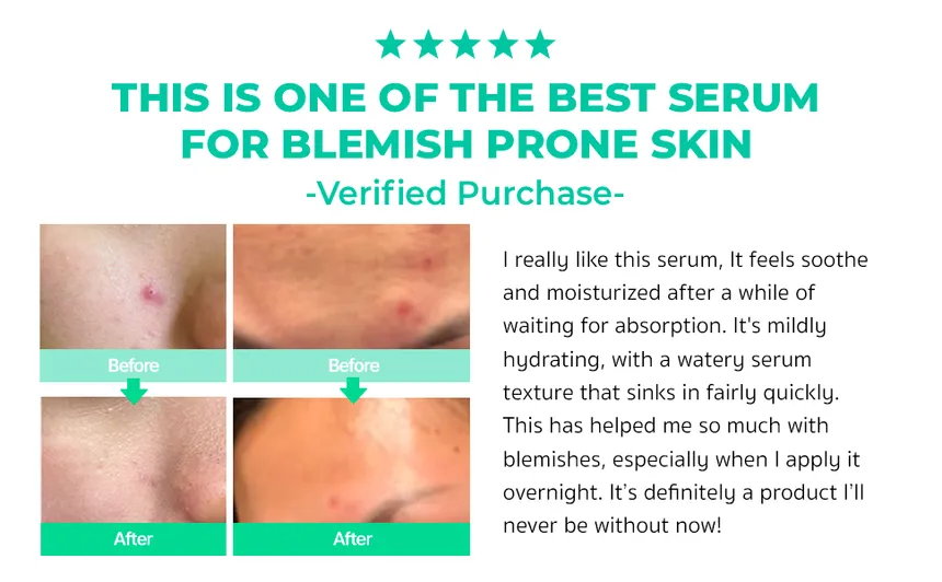BRING GREEN Zinc Teca Blemish Serum Set Squid Game Edition - Image 2