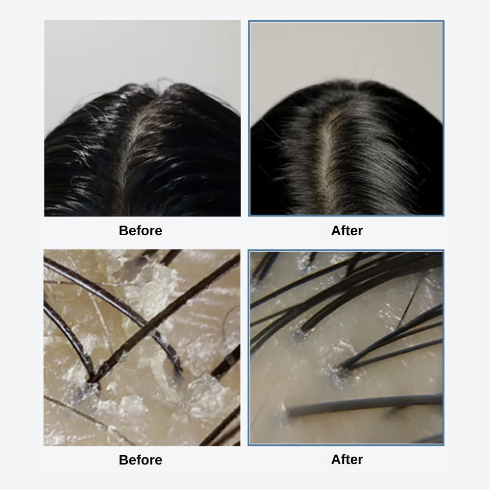 GROWUS Sea Salt Therapy Scalp Scaler 250g - Image 5