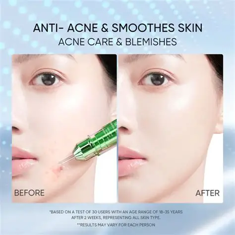 SKINTIFIC 3X Acid Intensive Pimple Spot 11g - Image 5