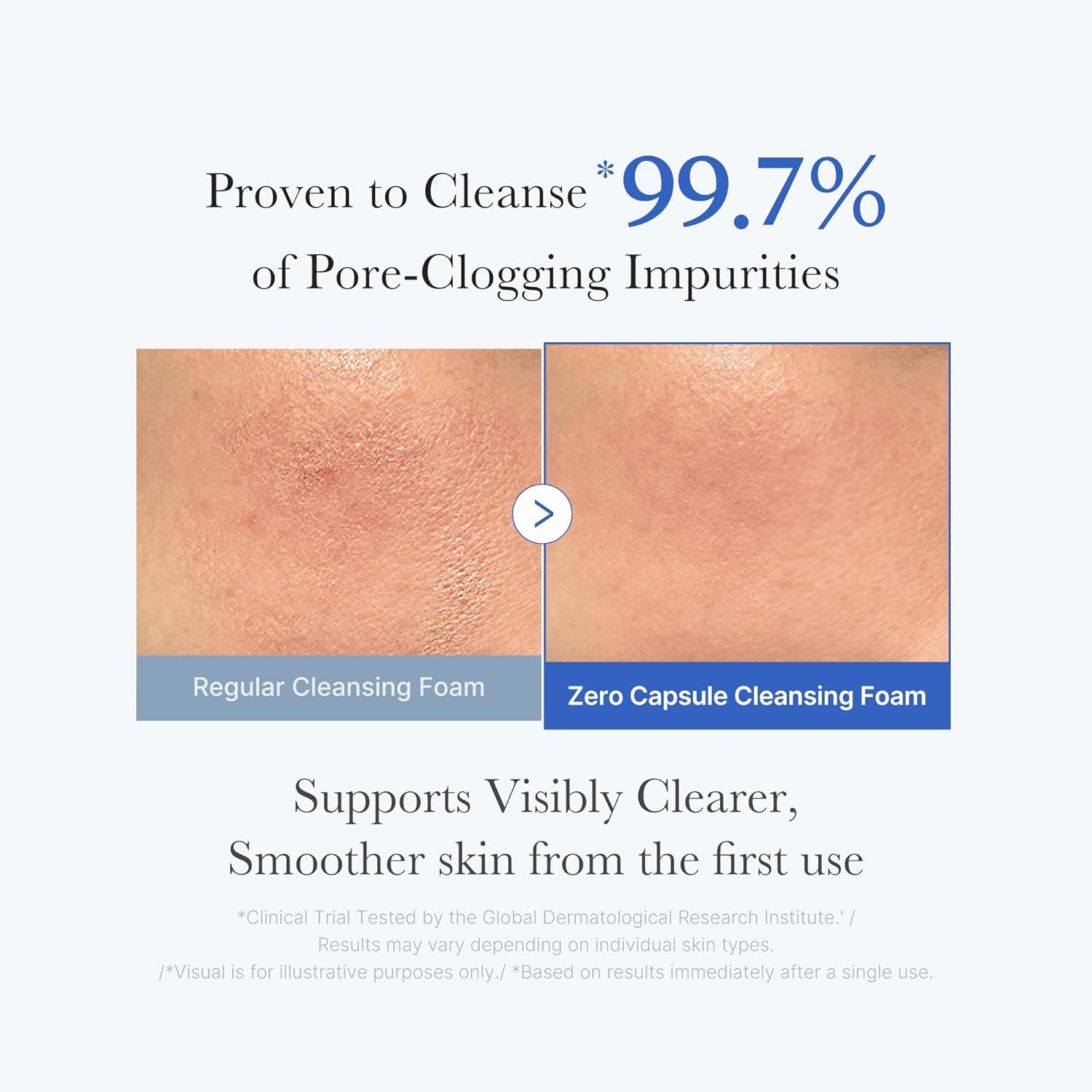 MEDICUBE Zero Pore SA Clear Capsule Cleansing Foam 120g - Image 3