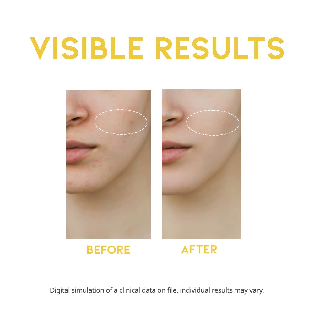 #OOTD Dark Spot Vitamin C Serum 50ml - Image 3