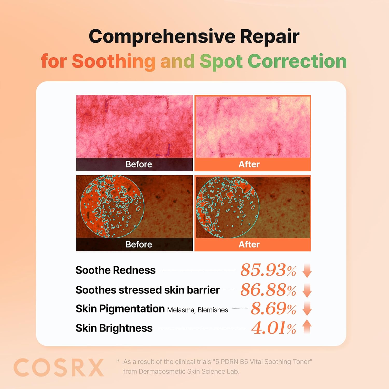 COSRX 5 PDRN B5 Vital Soothing Toner 280ml - Image 6