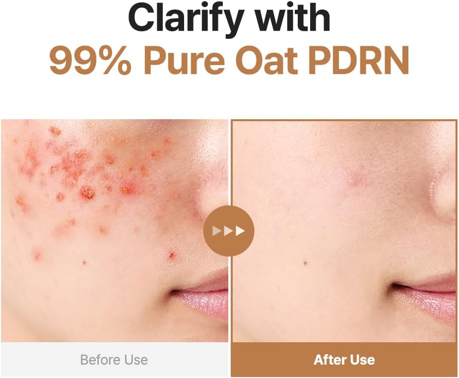 PURITO SEOUL Oat In PDRN Gentle Refining Toner 200ml - Image 2