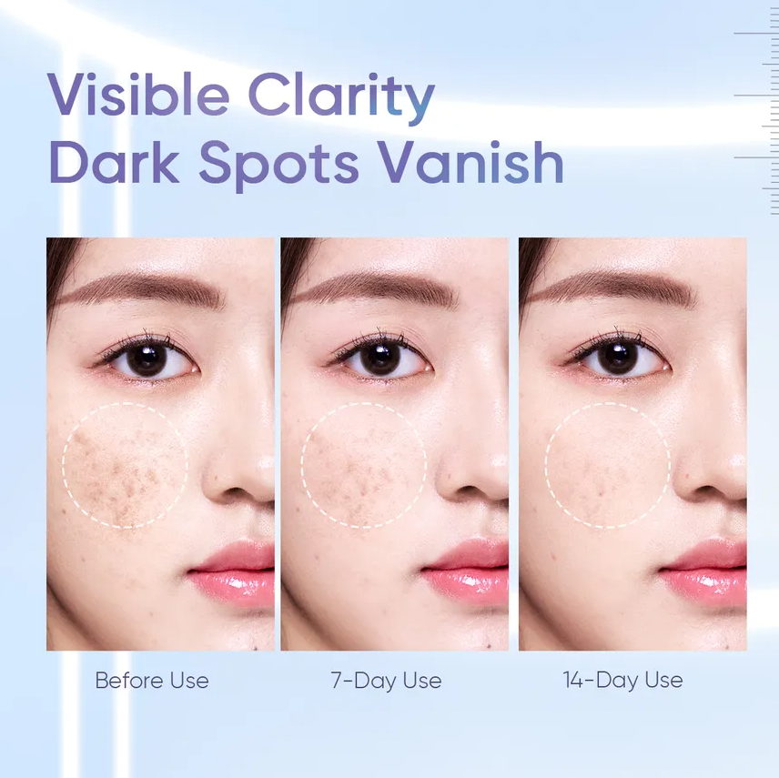 SKINTIFIC 377 Dark Spot Essence Toner 80ml - Image 5