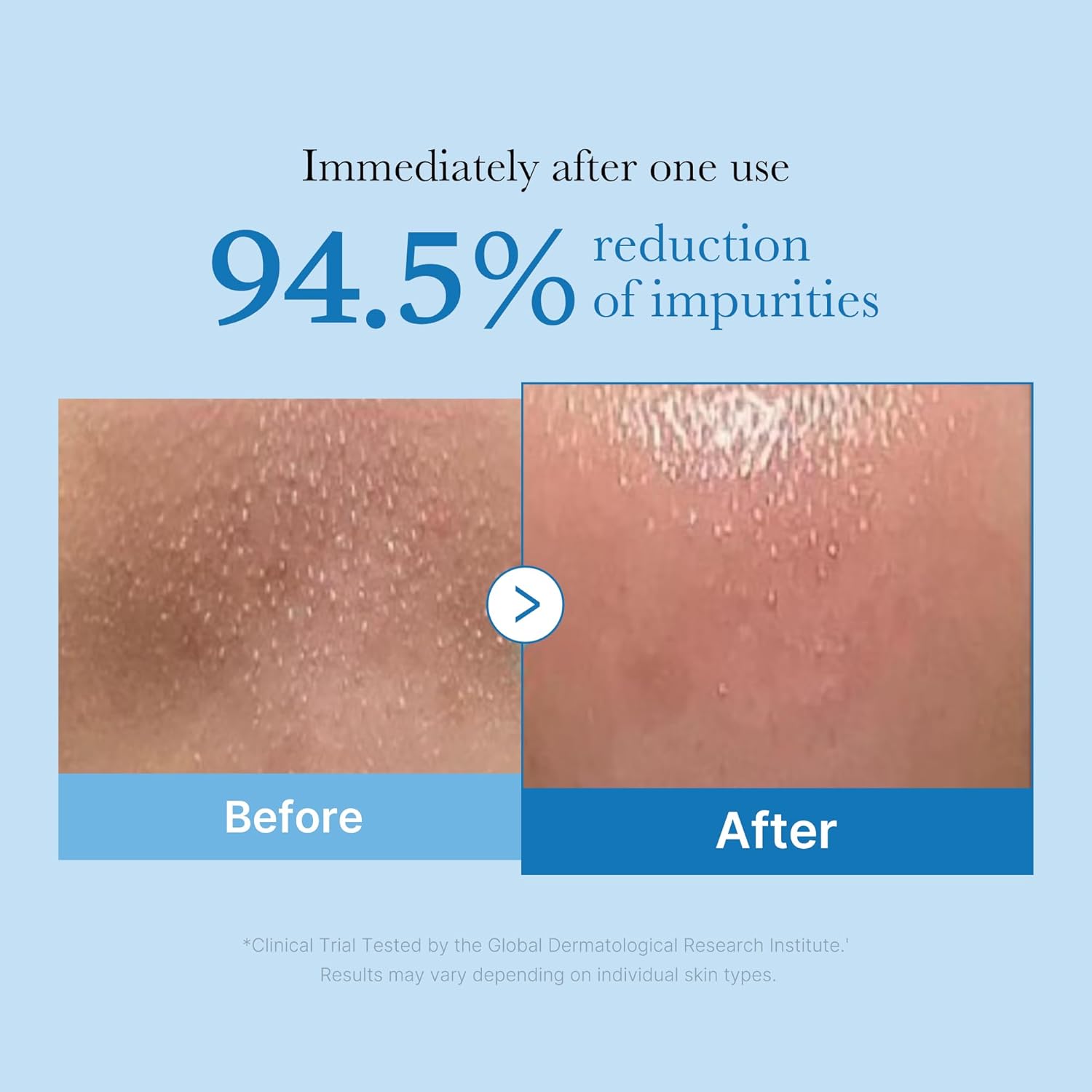 MEDICUBE Zero Pore Blackhead Cleansing Oil 205ml - Image 2