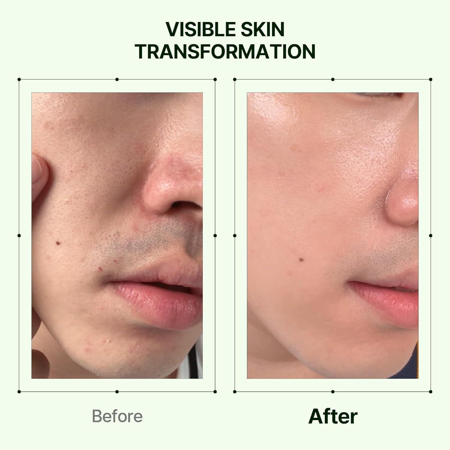 ORIEN Mugwort + Collagen Pore Serum 30ml - Image 6