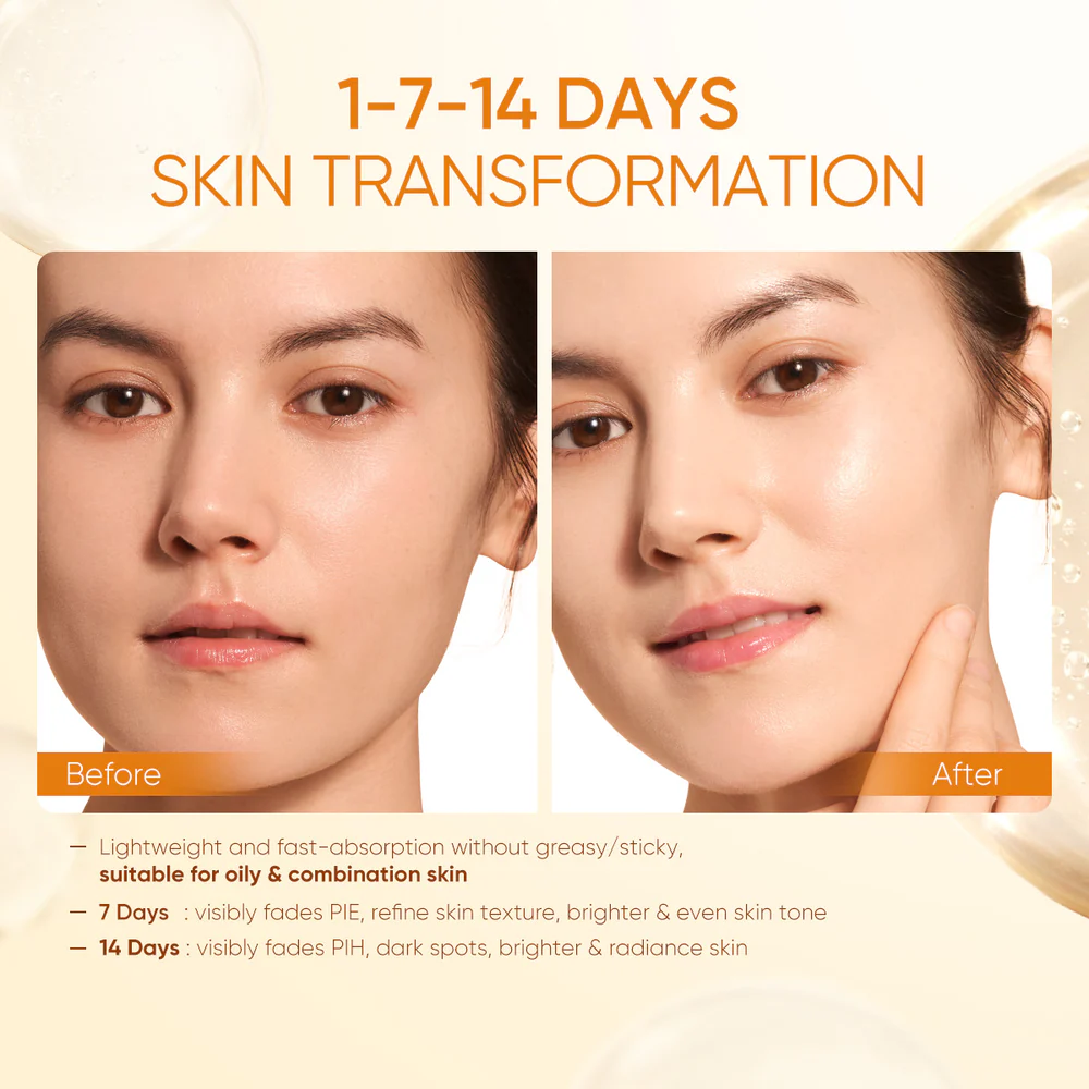 SKINTIFIC Vitamin C Brightening Boost Moisturizer 30g - Image 3