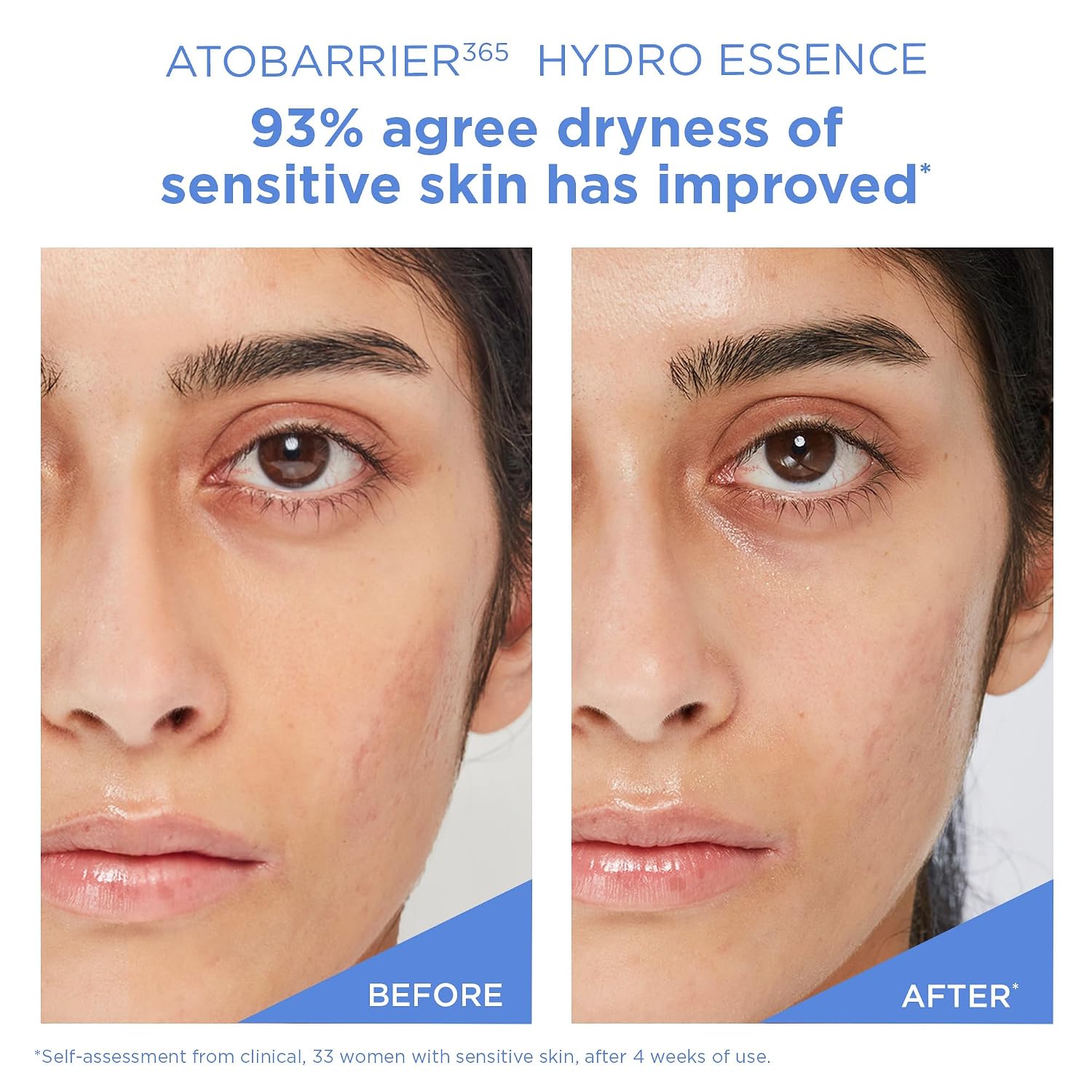 AESTURA Atobarrier 365 Hydro Essence 200ml - Image 6