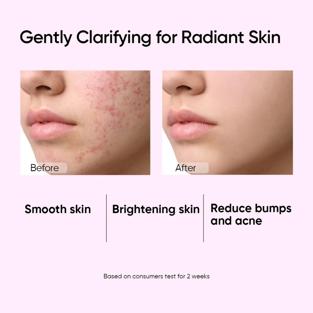 SKINTIFIC Glycolic Acid Daily Clarifying Toner 80ml - Image 3