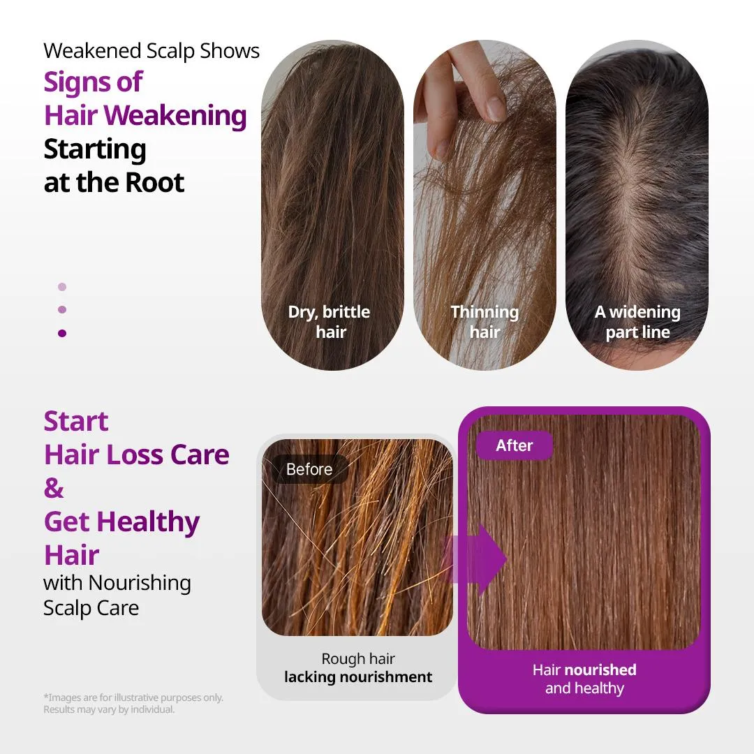 VT Reedle Shot Hair Boosting Scalp Pack 250ml - Image 3